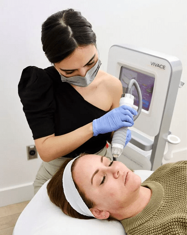 Vivace RF microneedling skin tightening treatment on face