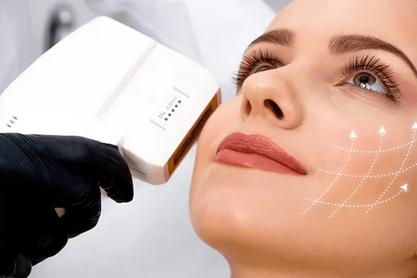 HIFU treatment being performed on a woman's face
